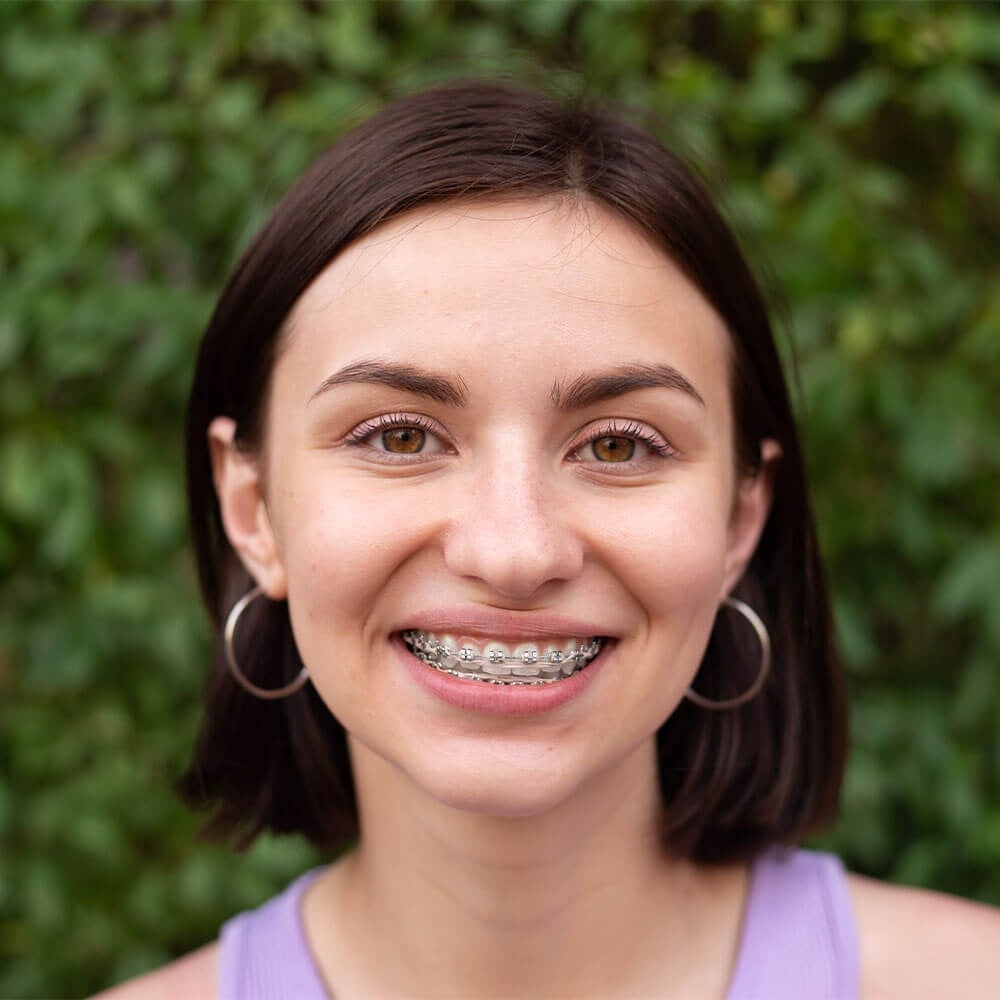 Braces